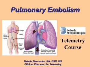 pulmonary-embolism-1-728